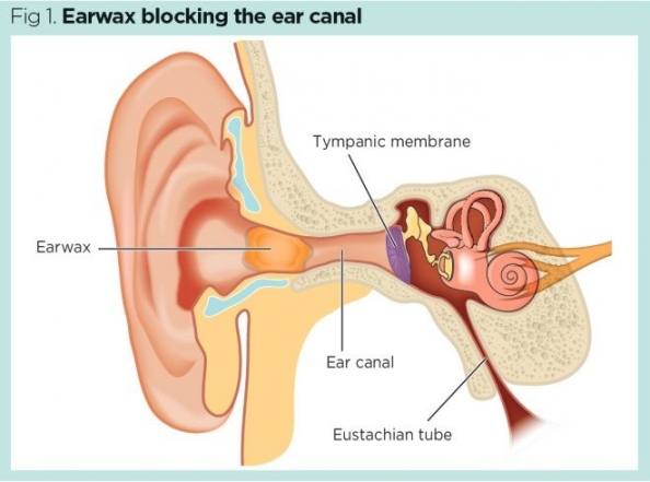 How To Care For Our Ears